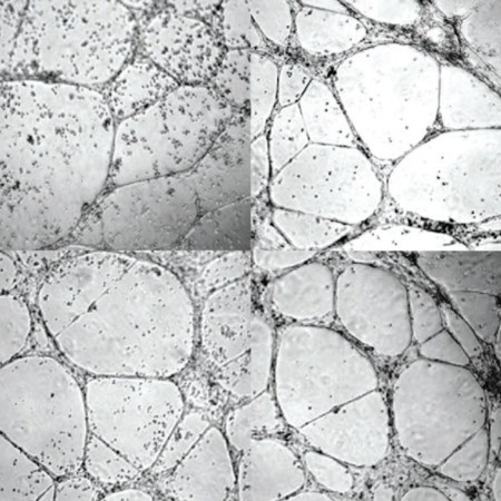 Este gel reconstruye vasos sanguíneos y podría ser una esperanza para los diabéticos