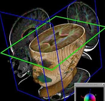 Avances para detectar lesiones en el cerebro del feto