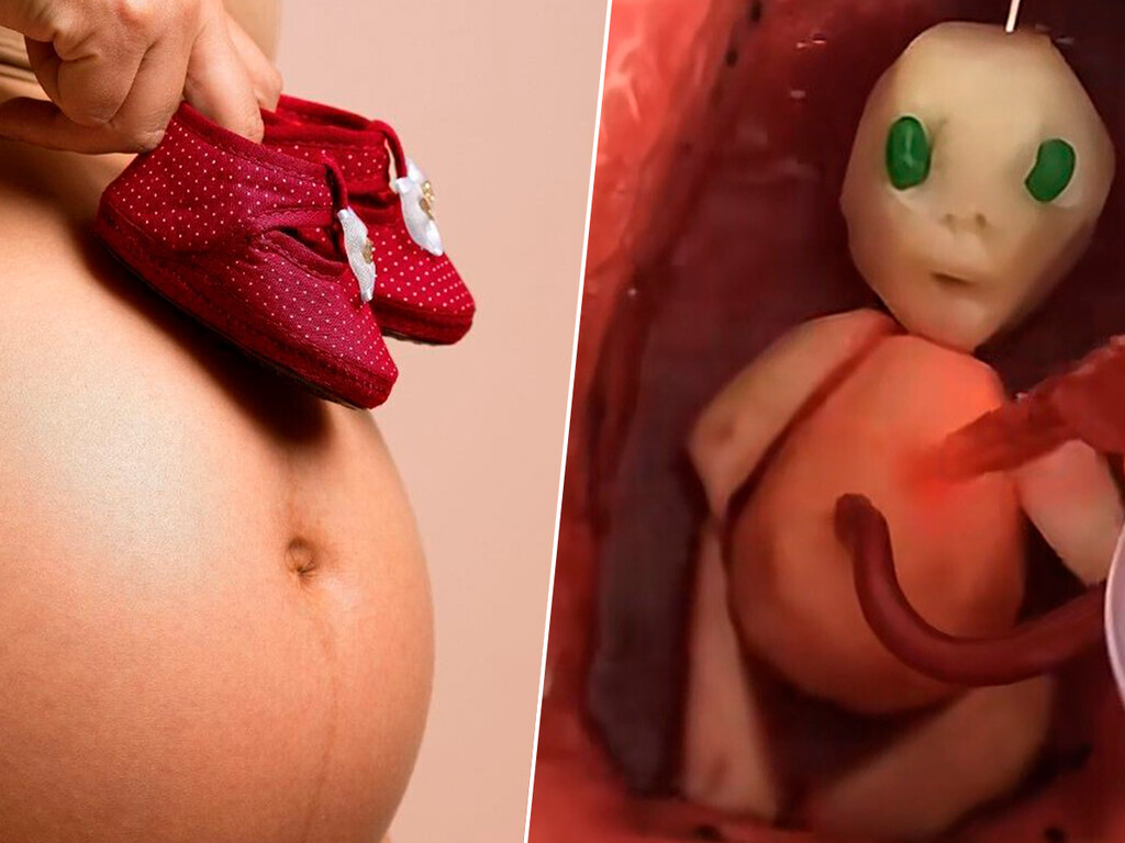 Un peculiar anuncio de embarazo con una sandía desconcierta a todo mundo: “¿El baby shower es para saber si será momia o alienígena?”
