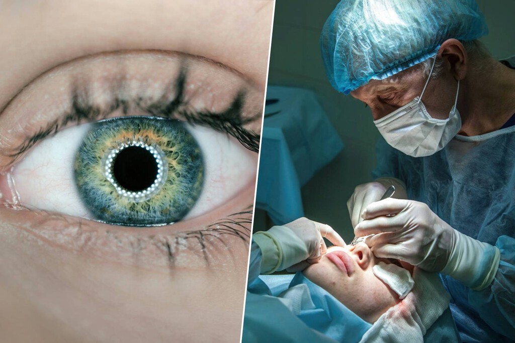 Sin láseres, sin cortes y en un minuto: la nueva técnica revolucionaria para decir adiós definitivamente a las gafas 