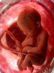 Sufrimiento fetal