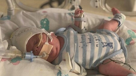 Archie, el bebé prematuro de 765 gramos que superó una infección por E.coli, una sepsis y el Covid