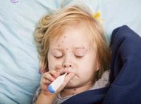 EE.UU. alerta de que cada vez hay más casos de sarampión 