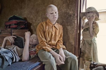 'Albino', de Ana Palacios: Libro y exposición que denuncia la situación de los albinos en África