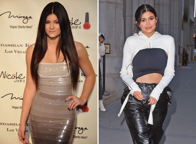 Kardashian Cirugia 02