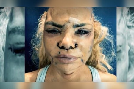 La impactante (y peligrosísima) operación estética de Leticia Sabater: se ha retocado TODO