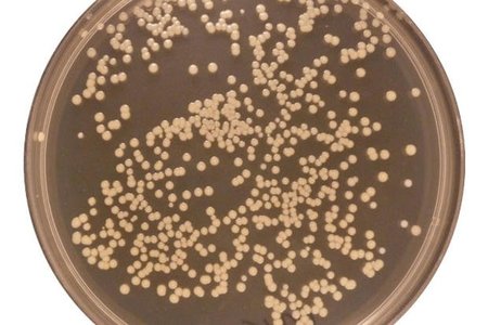 Se descubren en el ombligo humano 1.400 cepas diferentes de bacterias, 662 de ellas desconocidas