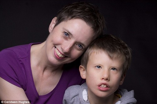 "Same but different": los niños detrás de sus enfermedades