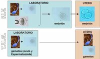 Transferencia de gametos: nueva técnica de reproducción asistida