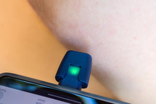 Toda la vida usando antipicaduras para los mosquitos y resulta que sólo necesitaba el móvil y este accesorio 
