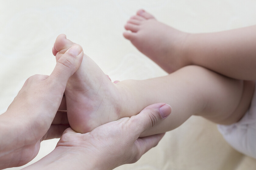 El Bebe Tiene Pie Zambo O Equino Varo En Que Consiste Esta Malformacion Congenita Y Que Tratamientos Hay Para Corregirla