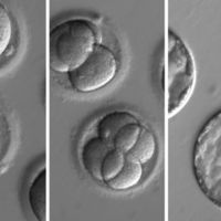 Avance histórico: por primera vez hemos sido capaces de eliminar una enfermedad hereditaria en embriones humanos