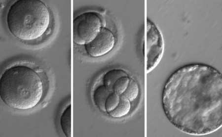 Avance histórico: por primera vez hemos sido capaces de eliminar una enfermedad hereditaria en embriones humanos