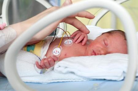 Habitaciones privadas para las familias, beneficiosas para los prematuros en cuidados intensivos