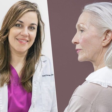 Carmen Orozco, médico y cirujana capilar: “Si arrancas una cana no salen más, puede que no vuelva a crecer más pelo” 