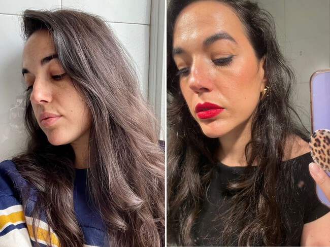 Seis Meses Usando Retinol Efectos Y Aspecto De La Piel 8