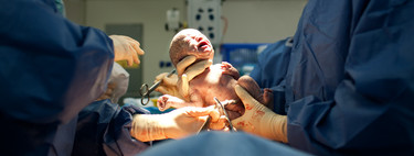 El 26 por ciento de los partos en España es por cesárea, el doble de lo recomendado por la OMS