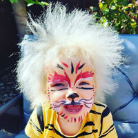 Esta adorable niña es una de las 100 personas en el mundo con el síndrome del pelo impeinable causado por una rara mutación genética