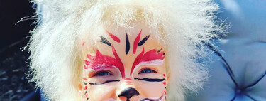 Esta adorable niña es una de las 100 personas en el mundo con el síndrome del pelo impeinable causado por una rara mutación genética