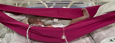 Colocar bebês prematuros em redes pode ajudá-los a sobreviver 