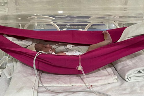 Bebê prematuro deitado em rede. Créditos: Agência UFC