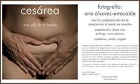 "Cesárea, más allá de la herida", libro y exposición