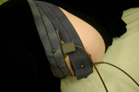 Condena de más de un millón de euros por no monitorizar al bebé en el parto