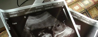 No desvelar el sexo del bebé para evitar abortos selectivos