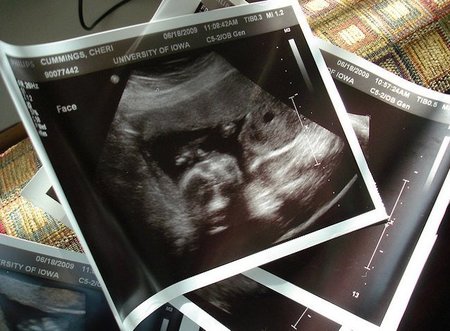 No desvelar el sexo del bebé para evitar abortos selectivos