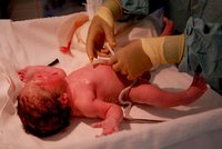 El 64% de los bebés nace con exceso de mercurio en sangre