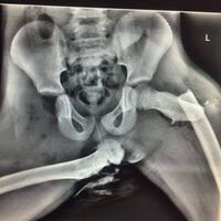 Esta radiografía prueba lo peligroso que puede ser viajar con los pies sobre el tablero