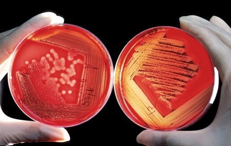 Los problemas de nacionalidad de los microbios de nuestro cuerpo