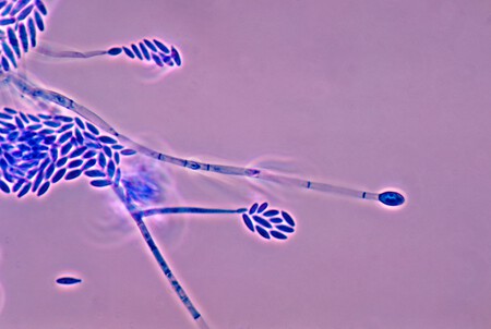 Fusarium Verticillioides 01