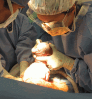 La cesárea aumenta el riesgo de complicaciones en los siguientes embarazos