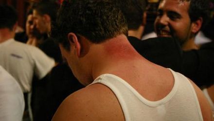 Las lesiones del penitente, ¿cómo prevenirlas?