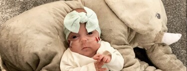 Una bebé prematura de 460 gramos de peso y solo un 10 por ciento de posibilidades de sobrevivir, ya está en casa con sus padres