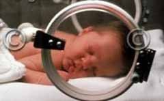Nitroglicerina: una esperanza para los bebés prematuros