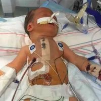 La madre de un bebé inmunodeprimido ruega a los demás padres que los niños enfermos se queden en casa