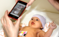 "BiliCam": una aplicación móvil para detectar la ictericia en tu bebé
