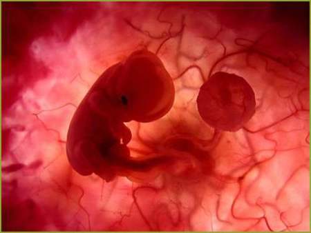 660 mujeres abortaron el año pasado por sexta vez