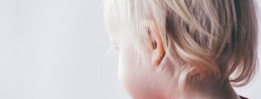 El niño tiene orejas de soplillo, un problema estético frecuente en la infancia 