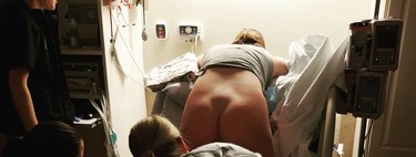 La impresionante fotografía que captura cómo se mueven los huesos de la madre durante el parto para abrir camino al bebé