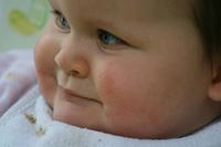 Darles antibióticos a los bebés antes de los seis meses podría provocarles obesidad 