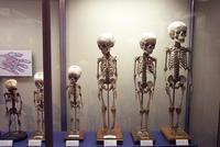 Cómo prevenir la osteoporosis desde la infancia 