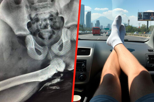 Airbag Tablero Pies 1