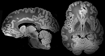 Nunca hemos visto un cerebro tan completo como este tras 100 horas de resonancia magnética