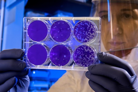 Coronavirus: en qué consiste la cepa 2019-nCoV (y cuántas posibilidades hay de que llegue a España)