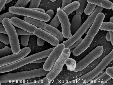 La bacteria E.coli, posible medio para obtener biocombustibles