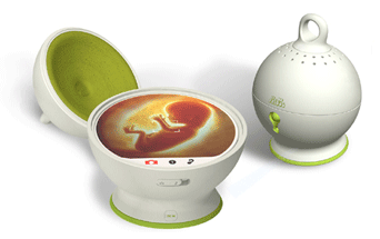 Aimo, sonogramas en casa