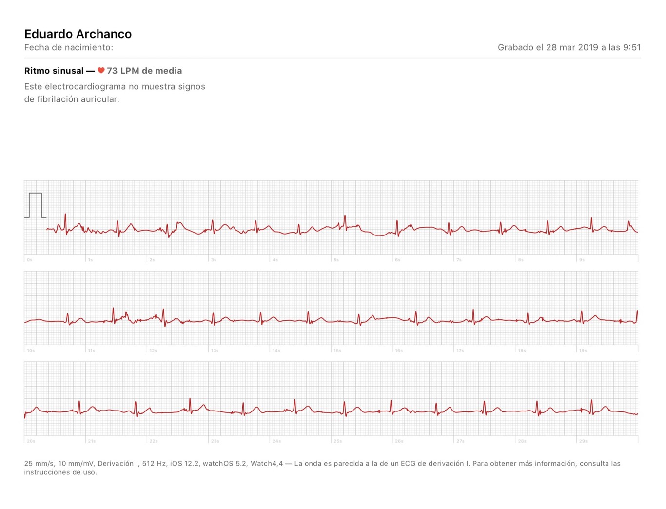 Cómo exportar en formato PDF tus pruebas ECG del Apple Watch Series 4